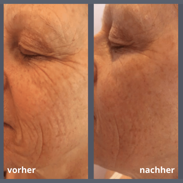 Mezotix® Studio MK Beauty Art Bad Langensalza