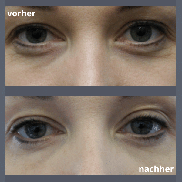 Mezotix® Studio MK Beauty Art Bad Langensalza