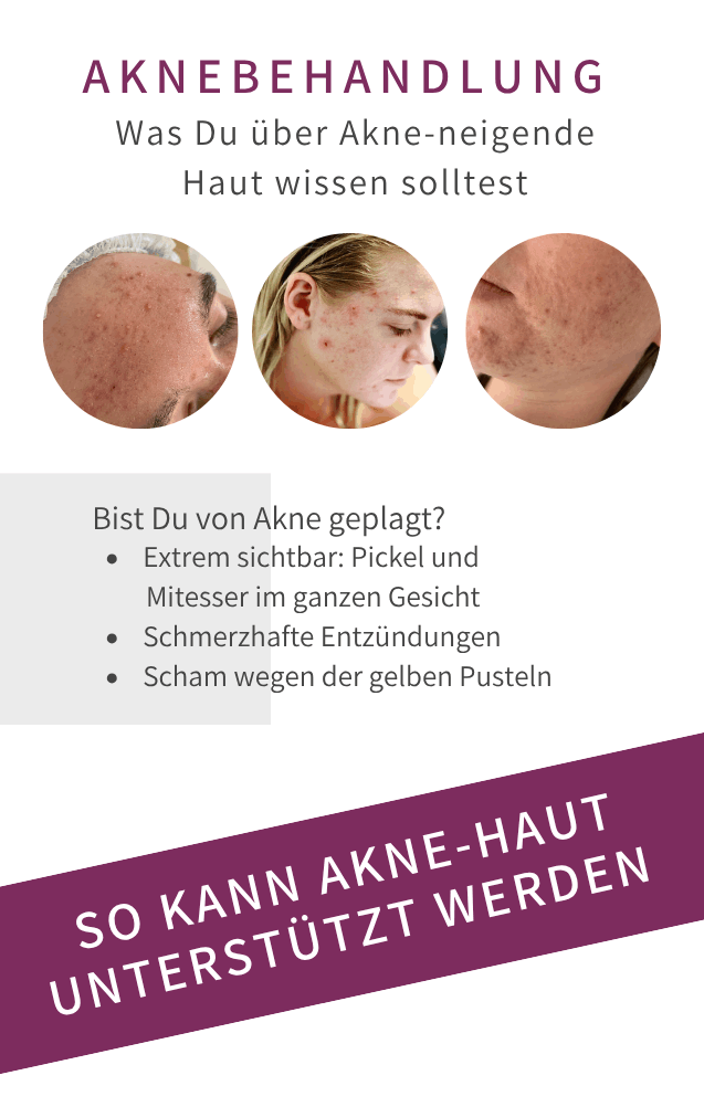 Akne Bad Langensalza Behandlung