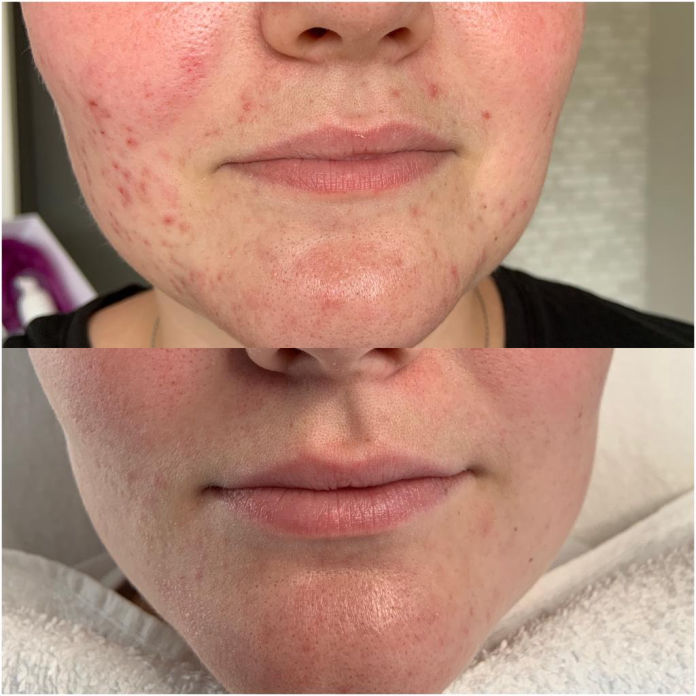 Akne Studio MK Beauty Art Bad Langensalza