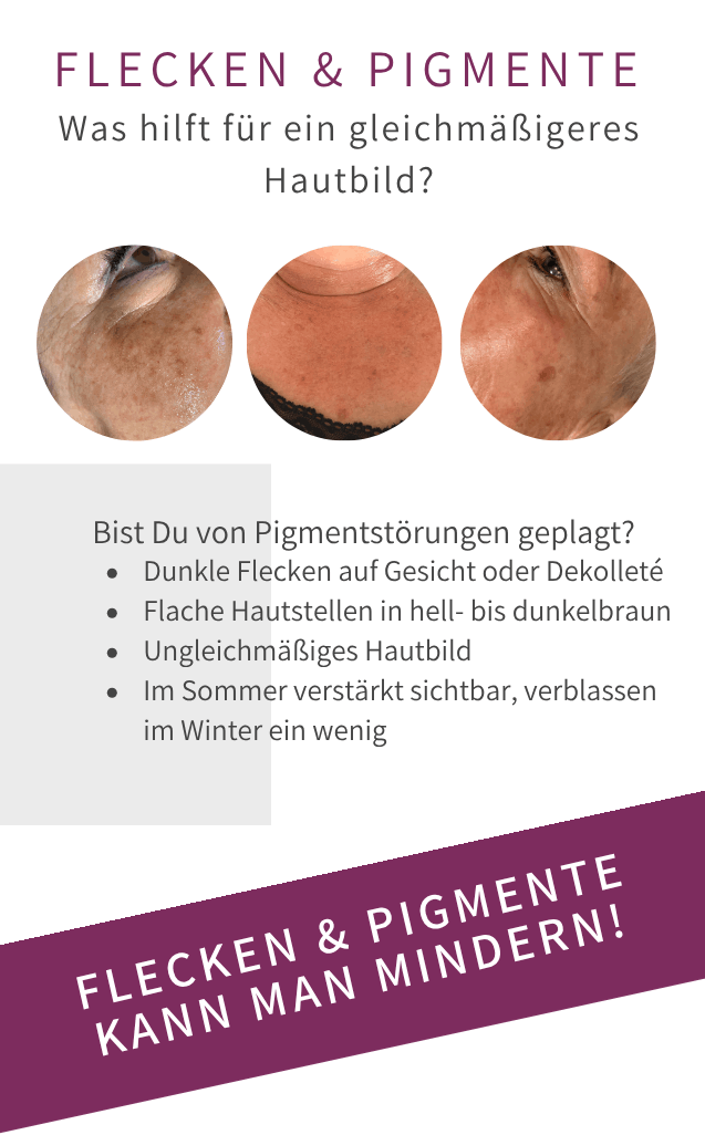 Altersflecken Pigmentstörung Bad Langensalza Behandlung