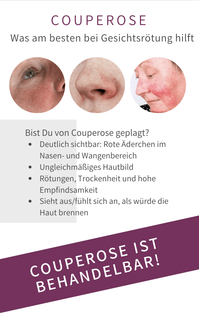 Couperose Rosacea Bad Langensalza Behandlung