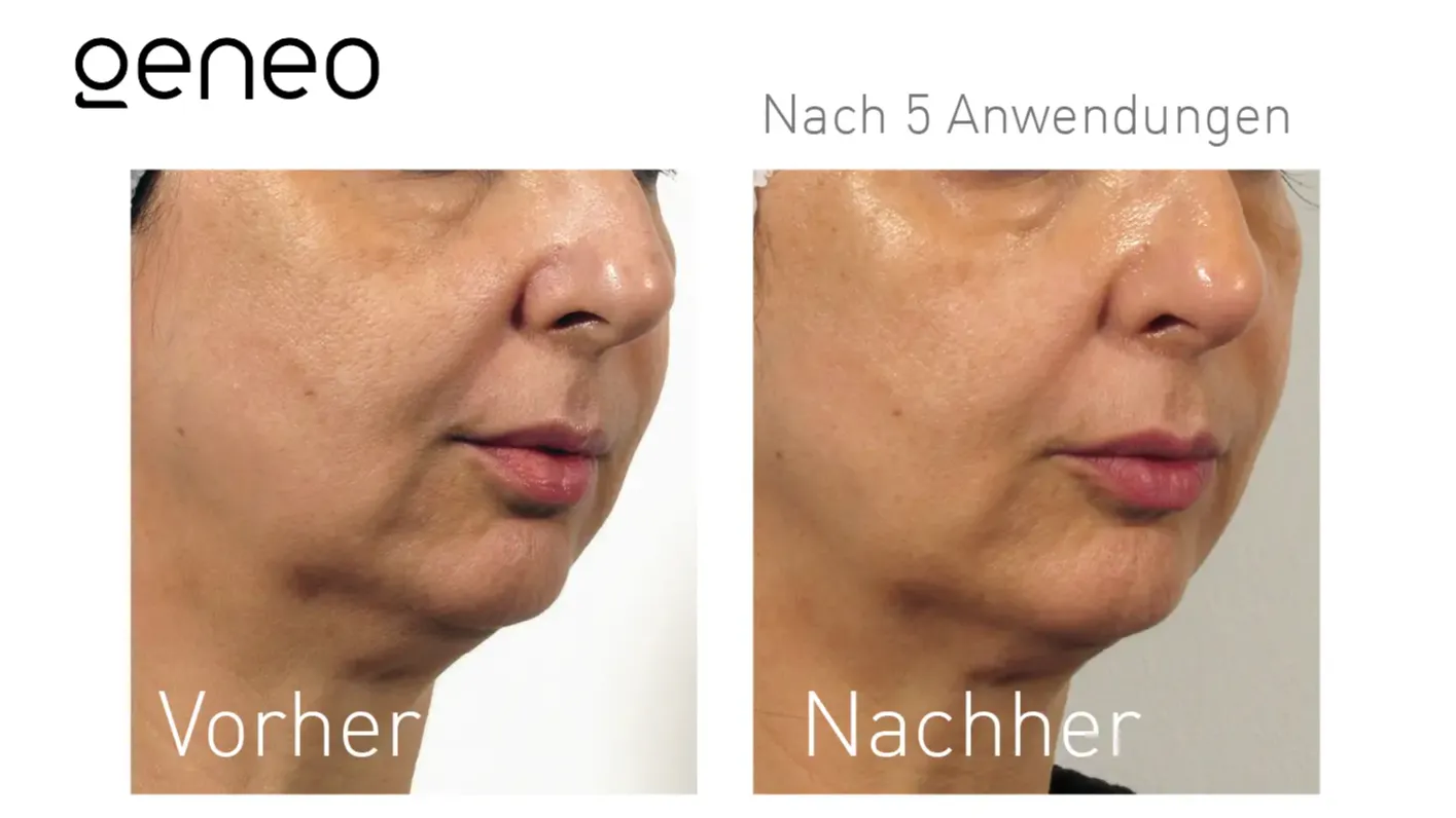 Oxygeneo® Studio MK Beauty Art Bad Langensalza