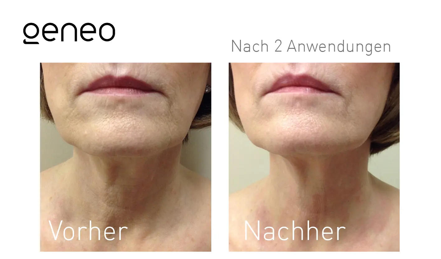 Oxygeneo® Studio MK Beauty Art Bad Langensalza