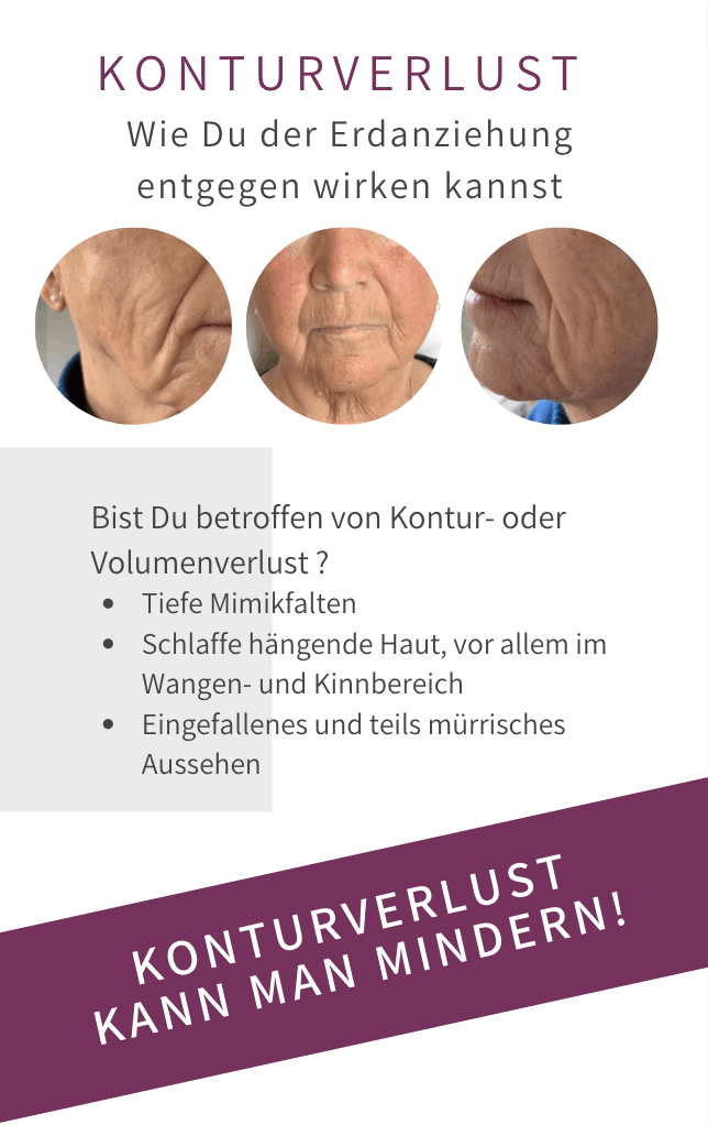 Konturverlust Hängebäckchen Bad Langensalza Behandlung