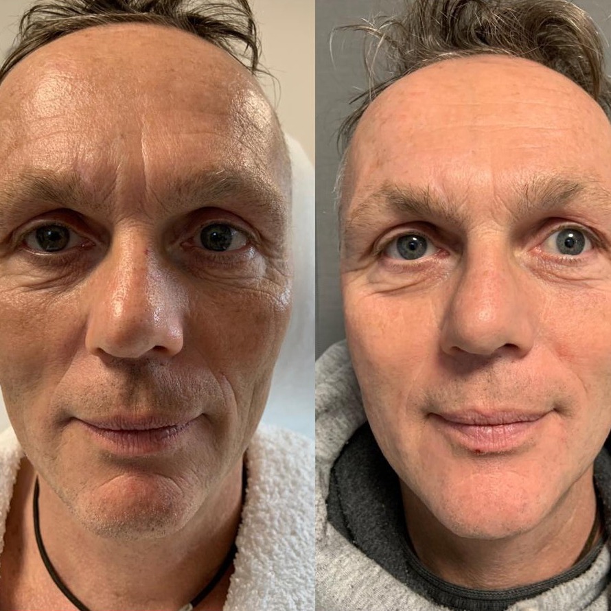 Mezotix® Studio MK Beauty Art Bad Langensalza