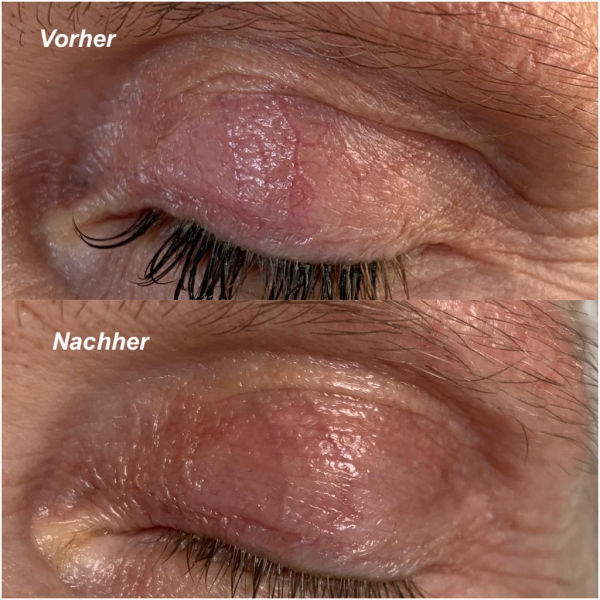 Mezotix® Studio MK Beauty Art Bad Langensalza