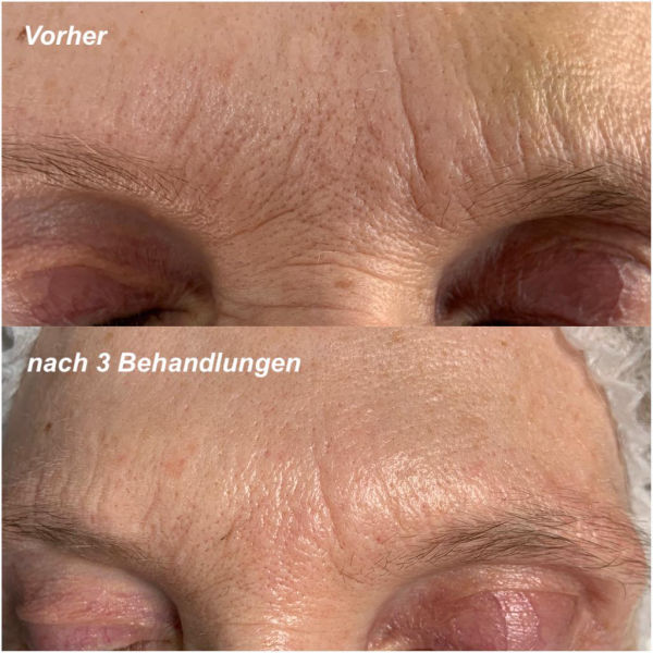 Mezotix® Studio MK Beauty Art Bad Langensalza