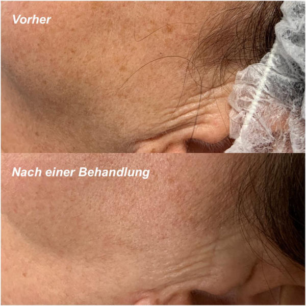 Mezotix® Studio MK Beauty Art Bad Langensalza